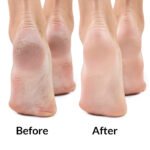 شيت ماسك سحري لقدم اكثر نعومة - الصورة 4